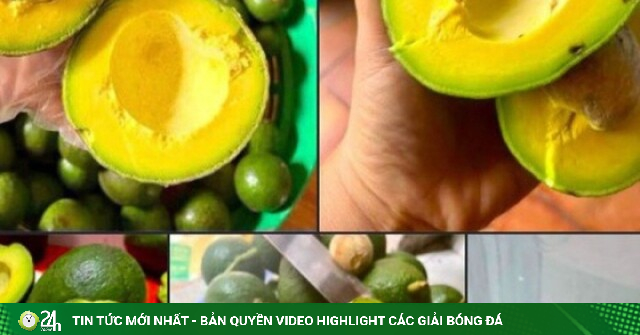 Bơ vào mùa bán tràn ngập thị trường, nên chọn loại bơ nào mới đáp ứng đủ các tiêu chí “ngon - bổ - rẻ”?