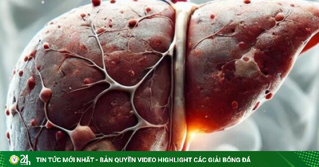 Ngứa mãi không hết, bác sĩ cảnh báo đừng chỉ nghĩ do dị ứng: Có thể gan đang gặp vấn đề
