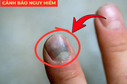  Nhiều người hối hận vì biết quá muộn!