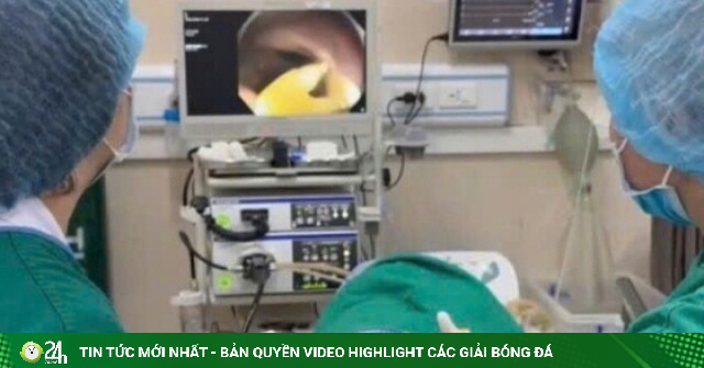 Bác sĩ gắp thành công sán dây bò dài 1,2m, cảnh báo nguy cơ từ thói quen nhiều người mắc phải