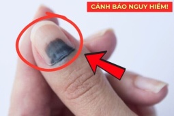  Nhiều người hối hận vì biết quá muộn!