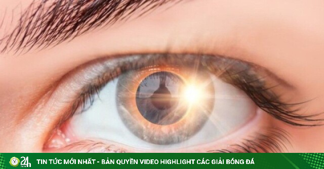 Cô gái suốt đời thấy hình lưỡi liềm trong mắt chỉ sau vài giây xem nhật thực