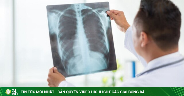 AI tìm ra nguyên tử bị ẩn mà tia X "bó tay"