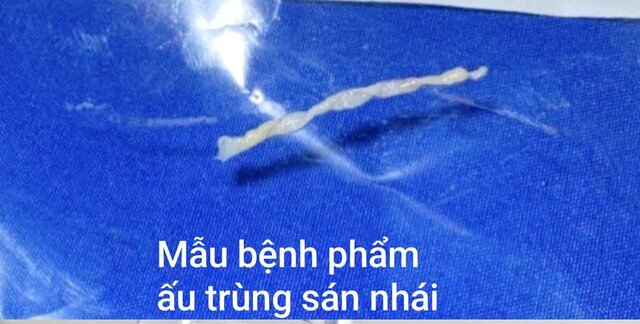 BVCC. 