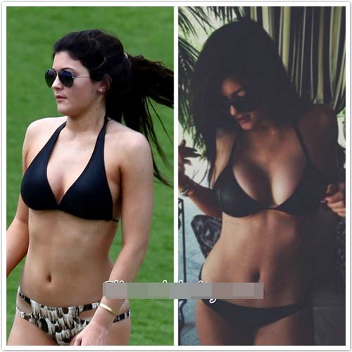 Bóc mẽ chuyện dao kéo của chị em Kardashian - 11