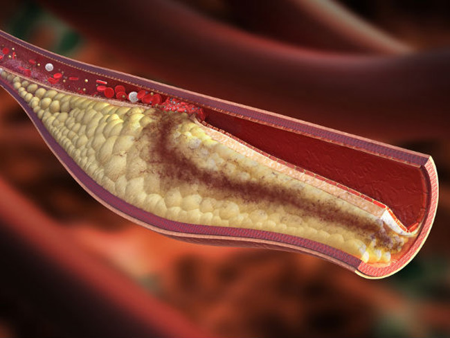 7. Giảm cholesterol: nếu đang cần giảm nồng độ cholesterol trong máu, bạn nên ăn dưa lưới hằng ngày vì loại trái cây này hoàn toàn không chứa cholesterol.