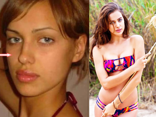 Vẻ đẹp của Irina Shayk là tự nhiên hay nhân tạo?