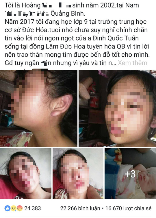 Mẹ trẻ 16 tuổi đăng Facebook cầu cứu vì bị chồng liên tục bạo hành - 2