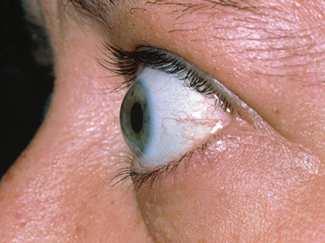 7 dấu hiệu ở mắt tưởng bình thường nhưng cho thấy bạn đang gặp nguy hiểm - 1