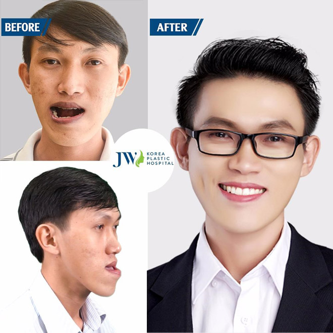 Top 10 gương mặt &#34;cực phẩm dao kéo&#34; của cuộc thi &#34;Nhan sắc mới, khởi đầu mới&#34; - 1