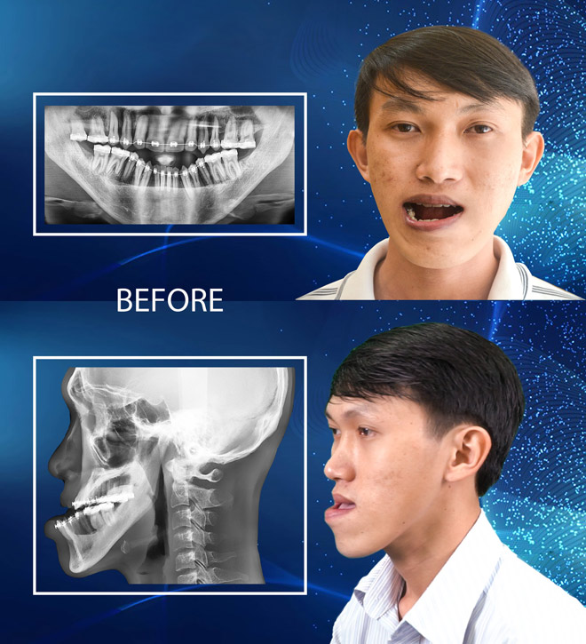 Cuộc sống vạn người mơ của thạc sĩ xe ôm sau “lột xác” - 1