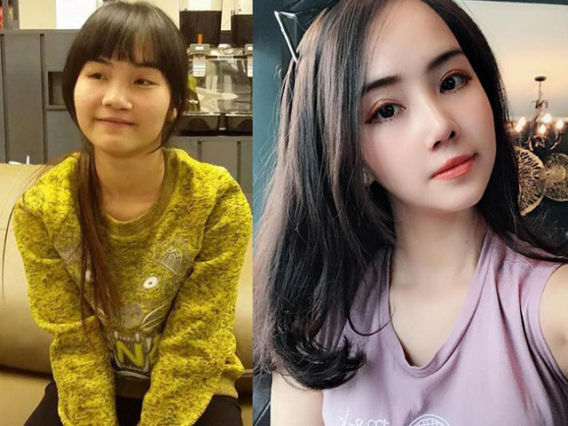 2 cô vợ Hà Nội, Quảng Ninh được chồng cưng như trứng mỏng sau khi sửa mặt