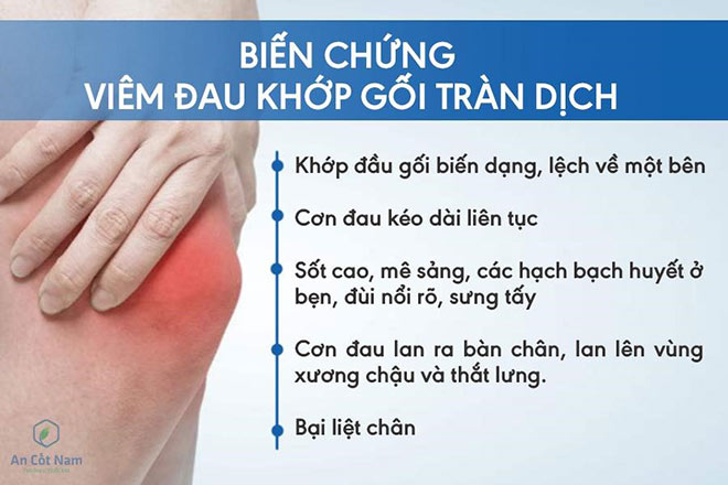 Viêm đau khớp gối trái, phải, tràn dịch: Nguyên nhân, triệu chứng và cách chữa - 3