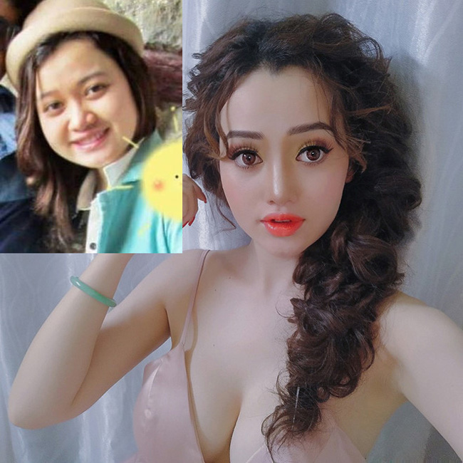 2. Cô gái Sài Gòn sinh năm 1995 Trương Ngọc Trân quyết định thẩm mỹ vì "dậy thì thất bại", có thân hình béo tròn, mũi to, mặt ngấn mỡ. 