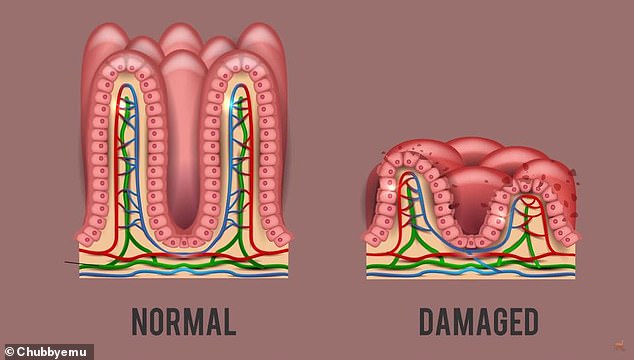 Uống 1 lít nước tương để giảm cân, người phụ nữ tê liệt não rồi tử vong - 4