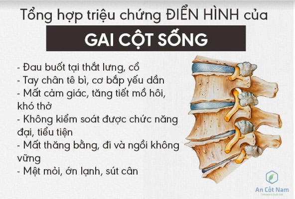 Gai cột sống: Nguyên nhân, triệu chứng và cách chữa nhờ bài thuốc toàn diện - 2