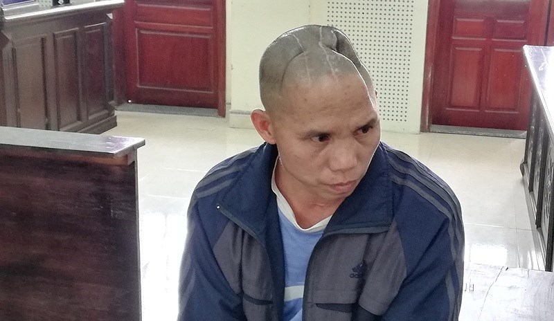 Bị mất nửa hộp sọ vẫn lãnh án về tội giết người - 1