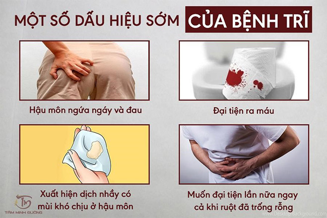 Bệnh trĩ là gì? Nguyên nhân, dấu hiệu và cách chữa bệnh hiệu quả - 2