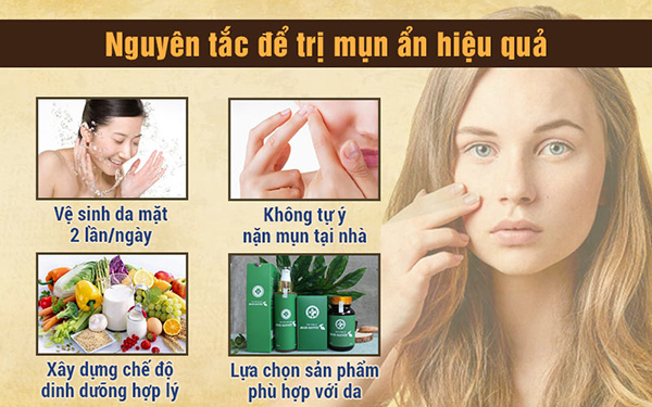 Trị mụn ẩn và những nguyên tắc cần tuân thủ để mụn không tái phát - 3