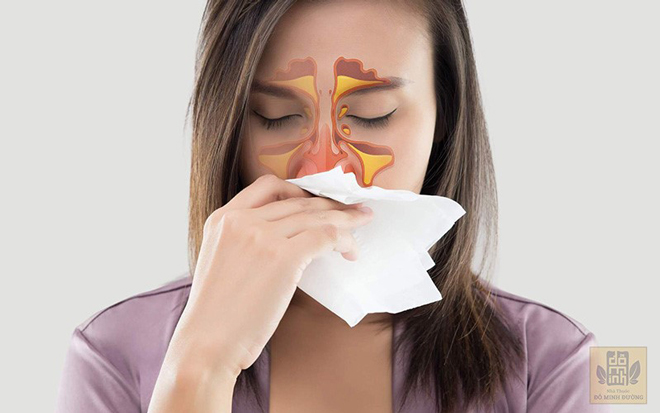 Bệnh viêm mũi xuất tiết là gì? Cách chữa trị hiệu quả từ thảo dược tự nhiên - 1