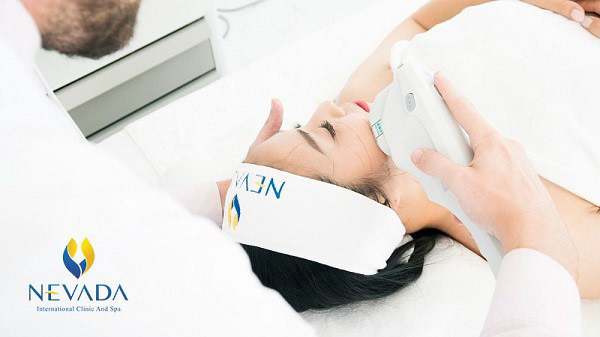 Công nghệ nâng cơ trẻ hóa da Ultherapy không cần phẫu thuật