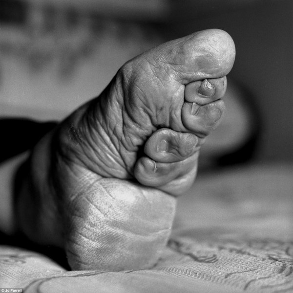 Đôi chân gót sen dị dạng của phụ nữ Trung Quốc thời phong kiến.&nbsp;