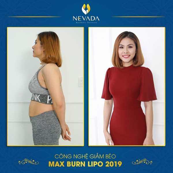 Diễn viên Vân Trang giảm cân sau sinh bằng công nghệ Max Burn Lipo