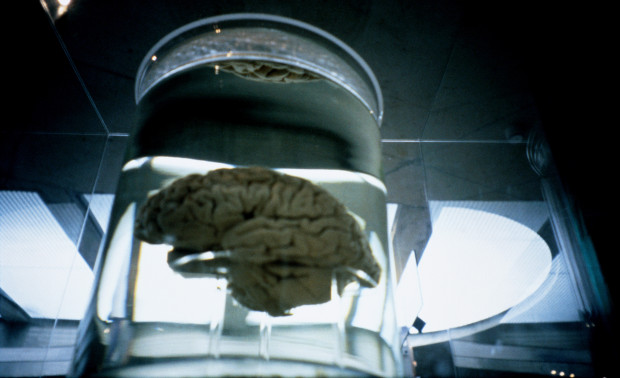 Các chuyên gia ngày nay mới chỉ nuôi&nbsp; dưỡng&nbsp;được một phần não người trong phòng thí&nbsp;nghiệm.
