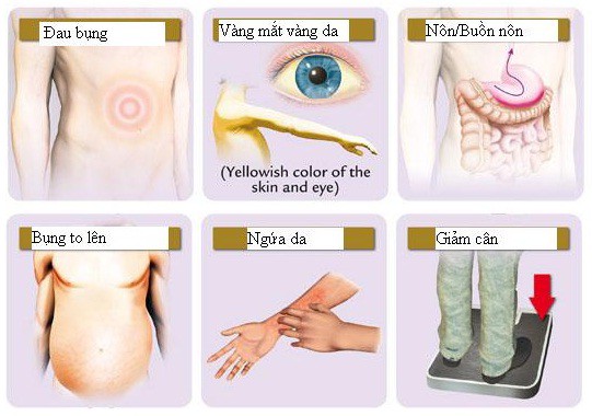 Ngứa liên tục có thể là dấu hiệu của căn bệnh ung thư có tỷ lệ mắc mới nhiều nhất tại Việt Nam - 1