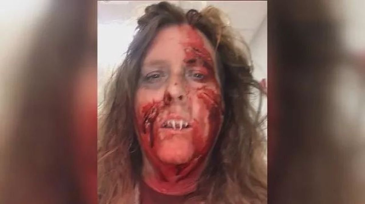 Anna Tew bị một phen khốn khổ với hàm răng giả của mình trong dịp Halloween (Ảnh: WKRG)