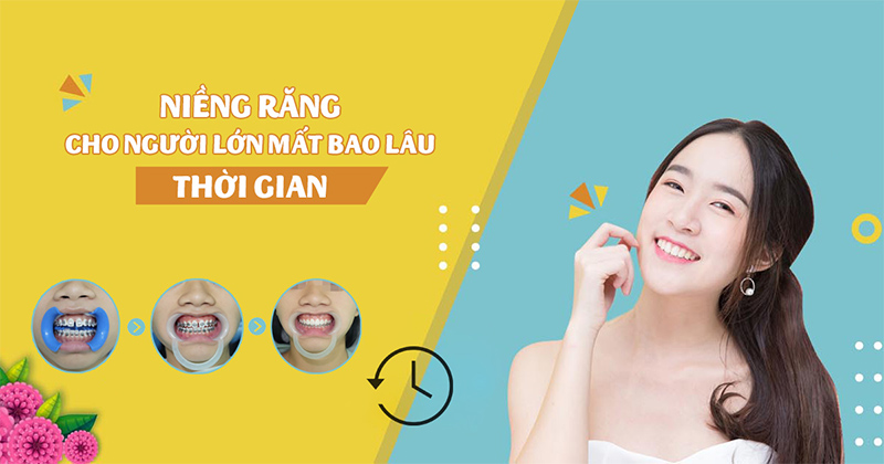 Niềng răng độ tuổi nào nên làm, thời gian niềng và những lưu ý - 8