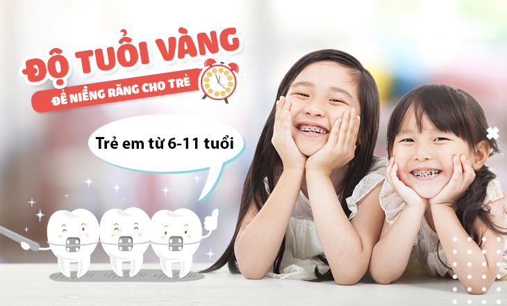 Niềng răng độ tuổi nào nên làm, thời gian niềng và những lưu ý - 6