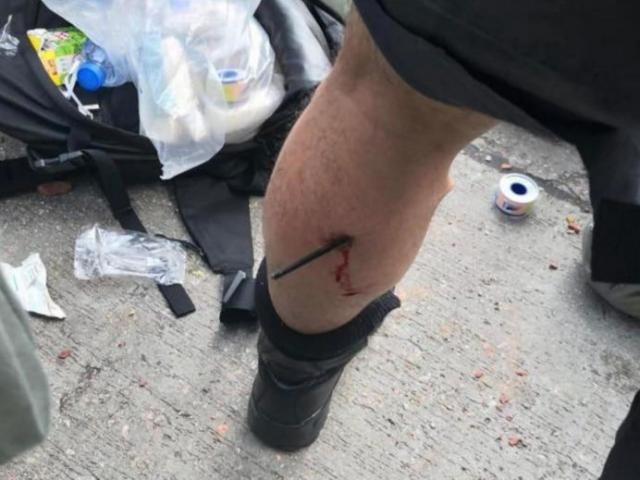Hong Kong: Cảnh sát bị tên bắn trọng thương trong cuộc đụng độ dữ dội với người biểu tình