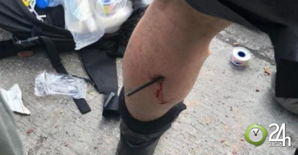 一名警察在與抗議者的衝突中腿部被箭射中