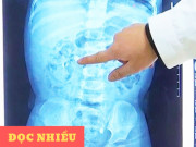 Tin tức sức khỏe - “Thủ phạm giấu mặt” gây tiểu nhiều lần được chuyên gia hé lộ trên kênh sức khỏe VTV2