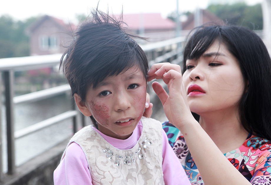 Câu chuyện về cô gái xinh đẹp Phạm Thùy Linh (28 tuổi, Hà Nội) nhận nuôi bé gái bị bệnh có khuôn&nbsp;mặt&nbsp;bị lở&nbsp;loét khiến nhiều người cảm động. Thời gian đầu, quyết định nhận nuôi bé gái của Linh bị nhiều người phản đối, hàng xóm kỳ thị, thậm chí xa lánh... nhưng&nbsp;cô đã gạt qua tất cả để chỉ dạy, chăm sóc bé.