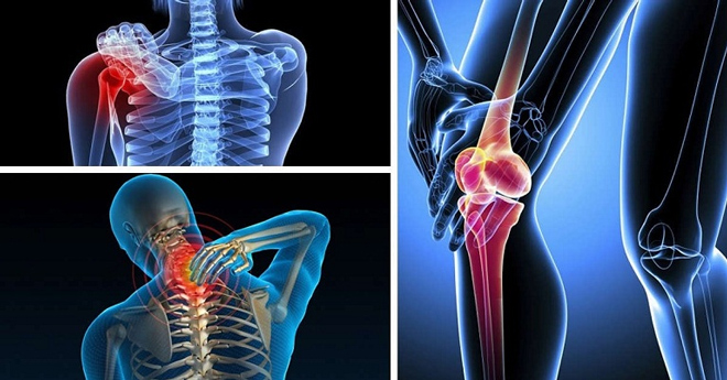 Viêm khớp là nguyên nhân hàng đầu gây tàn phế