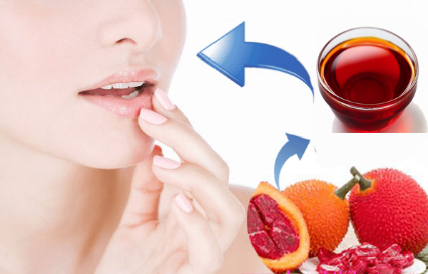 Cách trị thâm môi tại nhà nhanh dễ thực hiện mà hiệu quả - 13