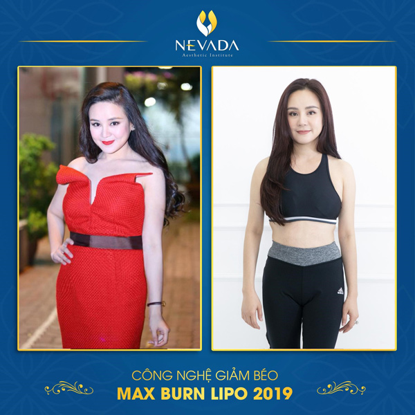 Ca sĩ Vy Oanh giảm cân thành công nhờ Max Burn Lipo