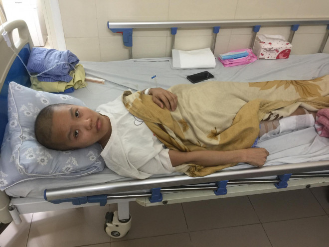 Hòa đang điều trị tại Bệnh viện K Tân Triều vì bị ung thư xương. Ảnh TG