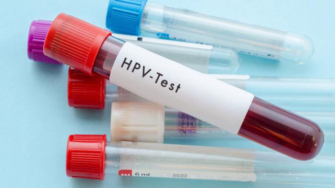 Xét nghiệm HPV rất có giá trị trong sàng lọc ung thư cổ tử cung.