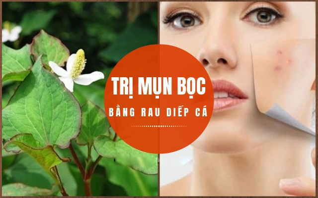 12 Cách trị mụn bọc sưng đỏ tại nhà an toàn hiệu quả nhất - 10