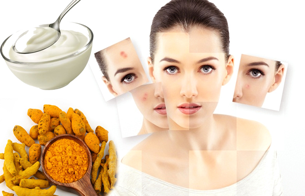 12 Cách trị mụn bọc sưng đỏ tại nhà an toàn hiệu quả nhất - 7