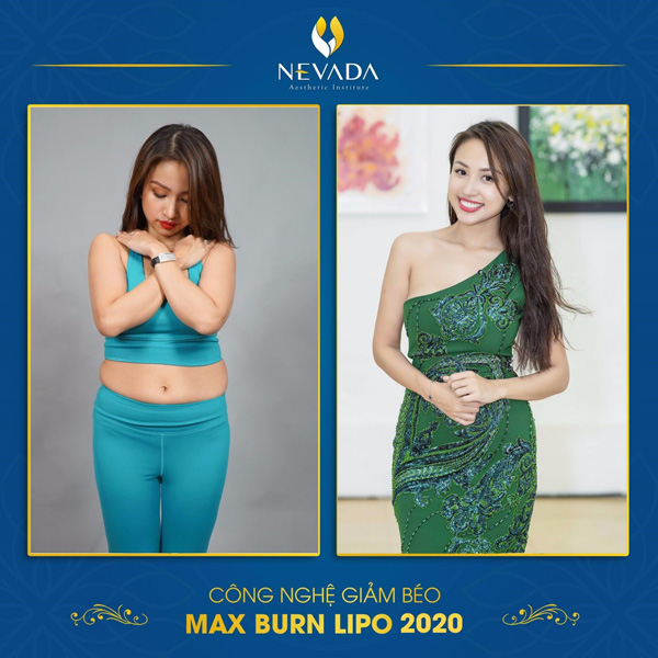 MC Vân Hugo trước và sau khi sử dụng Max Burn Lipo