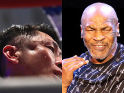 Thể thao - Nóng rực làng võ: Võ sỹ bị đá “lõm mặt”, Mike Tyson lại bị khiêu khích