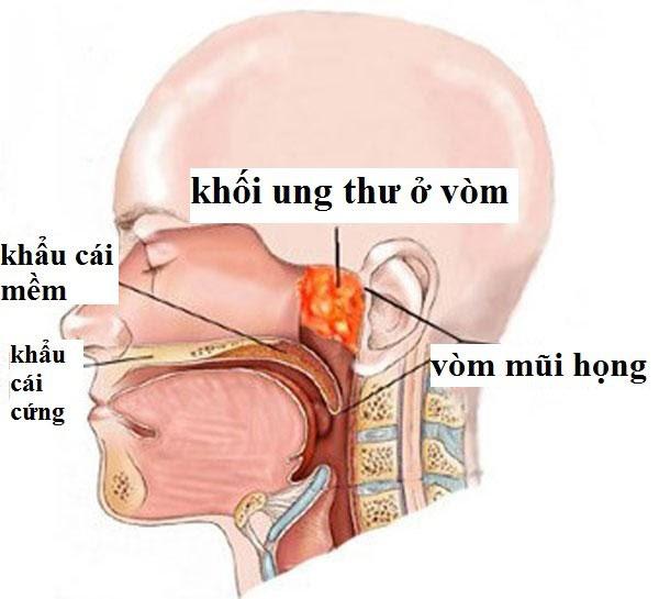 Các thực phẩm như cá muối, dưa cà muối bị khú được khuyến cáo không ăn ngay từ nhỏ. Ảnh minh họa