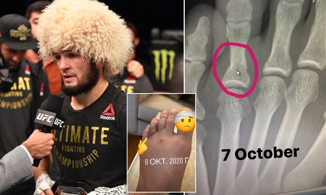 Khabib gãy ngón chân nhưng vẫn bảo vệ thành công đai UFC hạng nhẹ