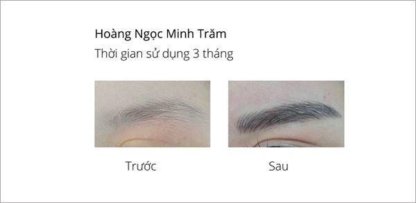 Kết quả trước và sau khi sử dụng serum mọc lông mày&nbsp; Revitabrow Advanced