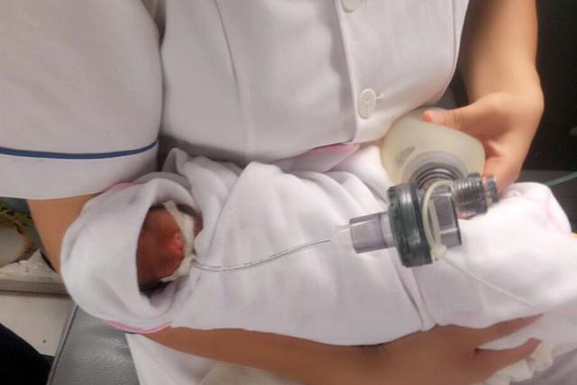 Hình ảnh bé Ốc sinh non cân nặng chỉ 480 gr tại bệnh viện Sản nhi Vĩnh Phúc - Ảnh: Bệnh viện cung cấp