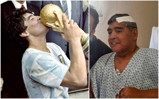 Maradona vừa phẫu thuật cục máu đông trong não cách đây hơn 2 tuần
